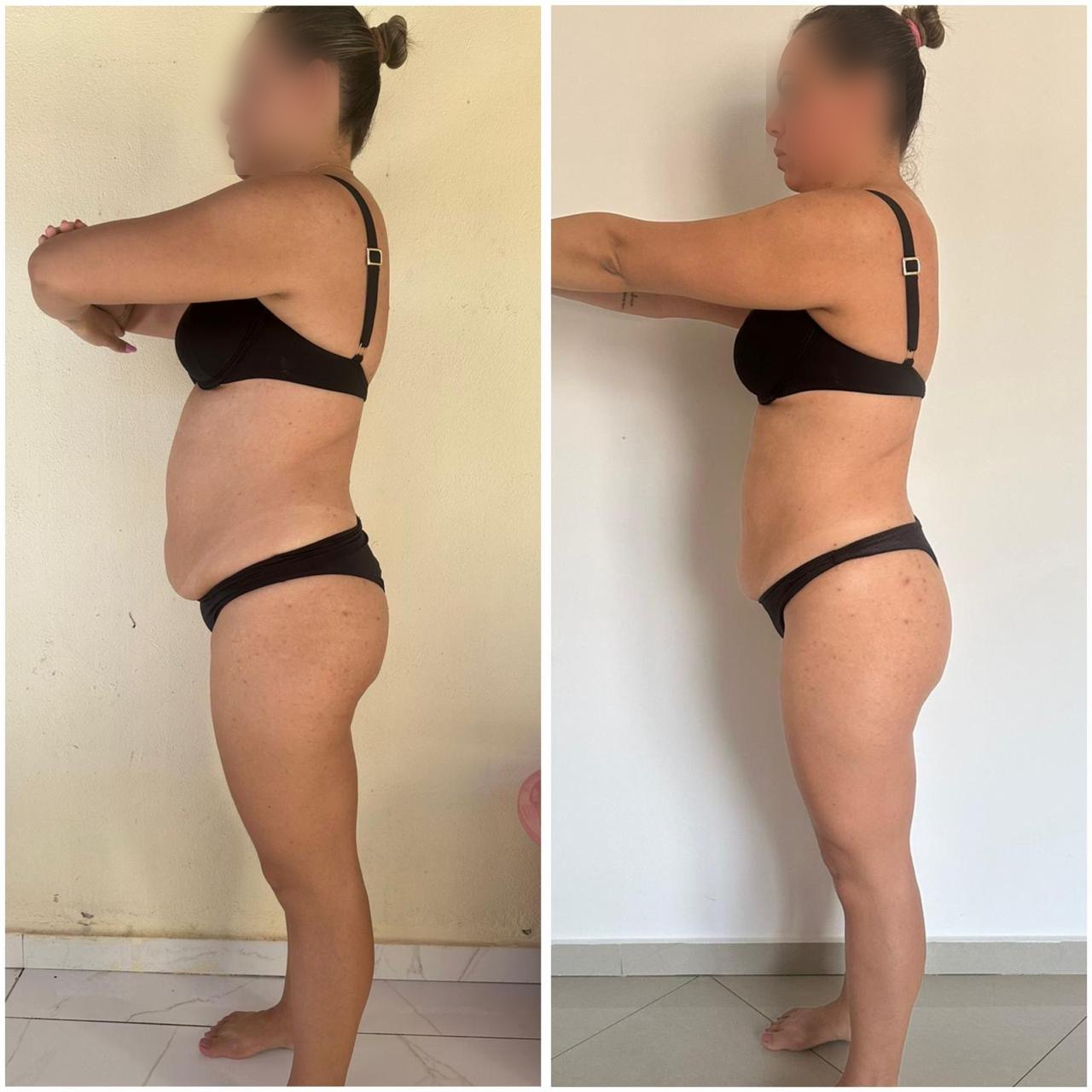 Aluna do Combustível Diário de perfil: à esquerda o registro anterior, à direita o atual, com a barriga visivelmente menor vista de lado.